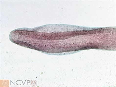  Diphyllobothrium: 探索寄生蟲的奇妙旅程！揭開這個令人驚訝的扁形動物的秘密！